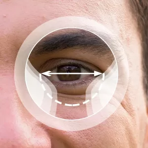 MULTIFOCAL PROGRESIVO BÁSICO